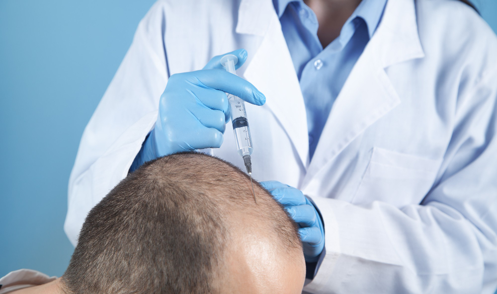doctor-makes-injection-in-the-man-head-for-hair-growth